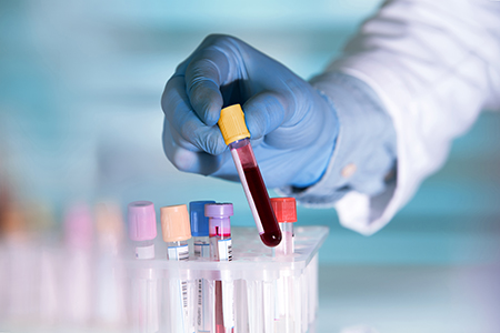 COVID-19 Antibody testing available at Huntsville Hospital Laboratory