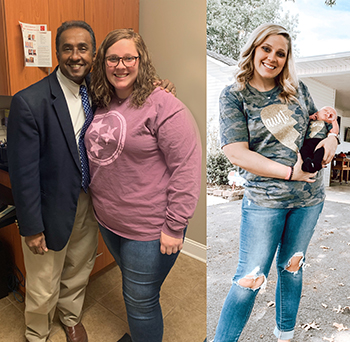 Courtney before & after bariatric surgery
